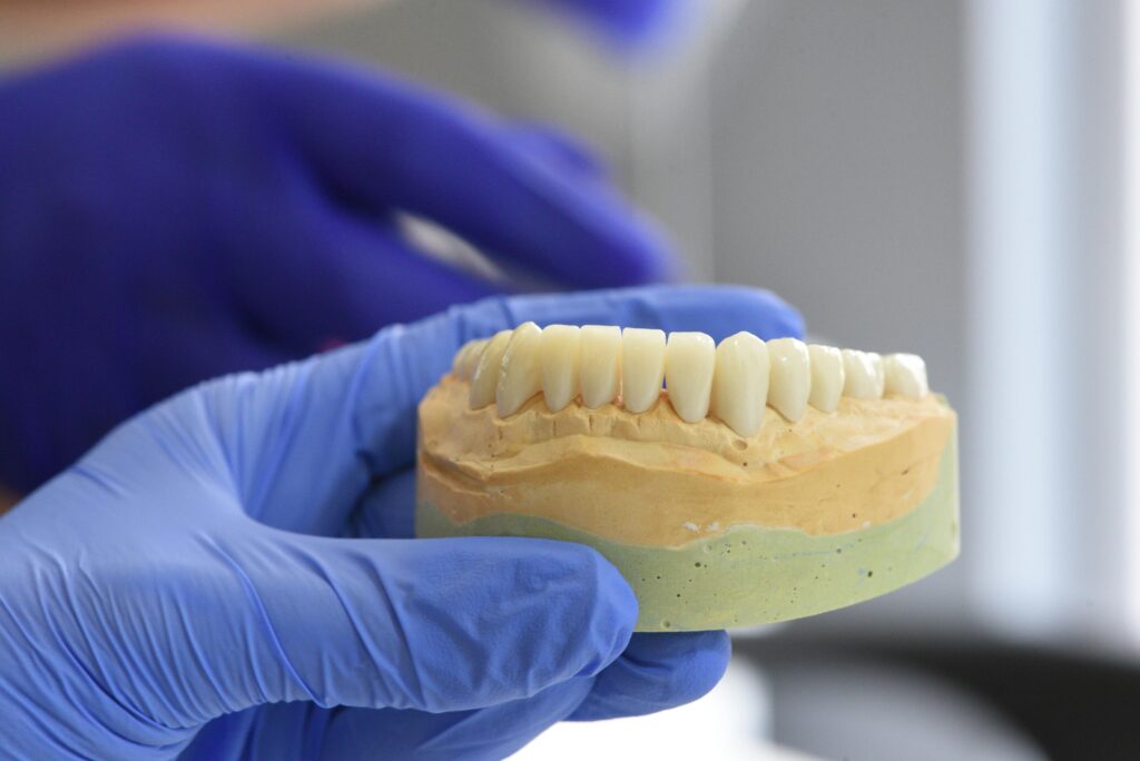 Dental implant pain explained using a dental model during treatment planning