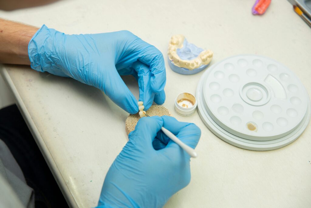 Dental implant cost Houston consultation and implant planning