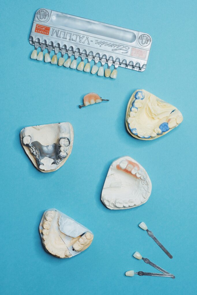 Dental molds and temporary teeth used for same-day dental implants in Houston