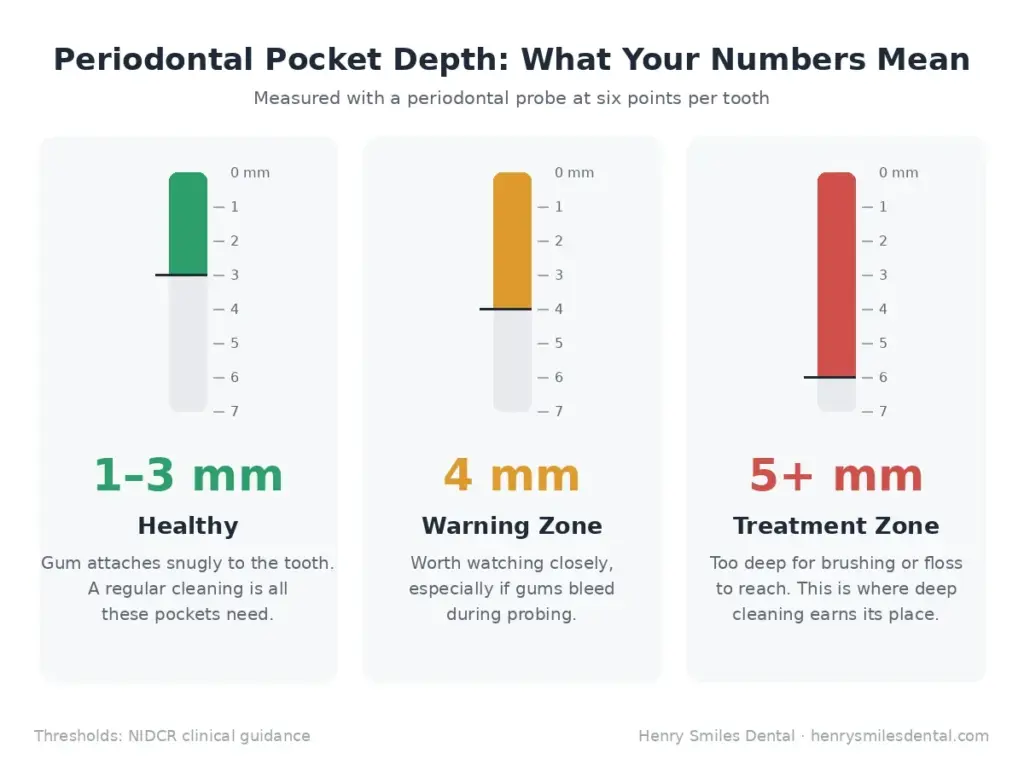 Periodontal pocket depth chart showing healthy 1–3mm, 4mm warning zone, and 5mm+ deep teeth cleaning treatment zone